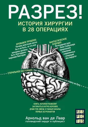 Разрез! История хирургии в 28 операциях | ван де Лаар Арнольд, в Узбекистане