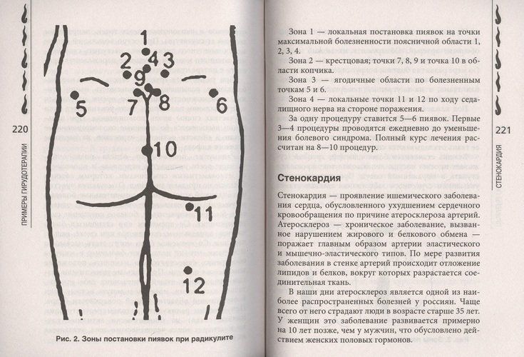 Пиявки лечат | Геннадий Кибардин, O'zbekistonda