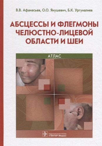 Абсцессы и флегмоны челюстно-лицевой области и шеи 18-19г. | Афанасьев