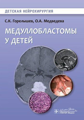 Медуллобластомы у детей | Горелышев