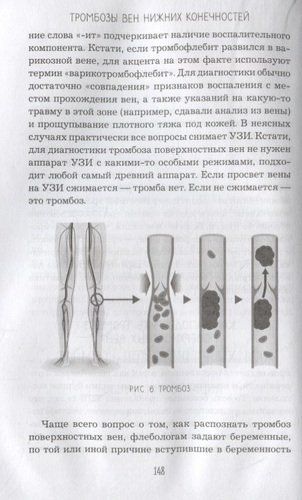 Внутривенно. Что происходит с сосудами, по которым движется ваша кровь, как вылечить то, что уже болит, и не допустить проблем в будущем | Евгений Илюхин, foto