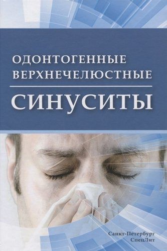 Одонтогенные верхнечелюстные синуситы | Цыган Василий Николаевич