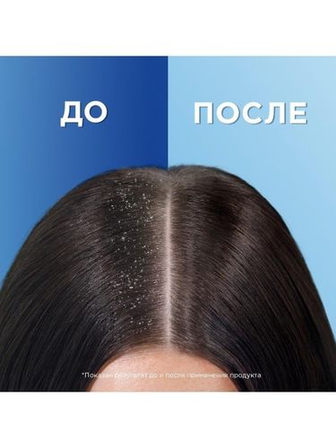 Шампунь Head & Shoulders 2в1 против перхоти Ментол, 600 мл, в Узбекистане