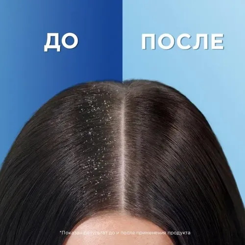 Шампунь Head&Shoulders Цитрусовая Свежесть, 400 мл, в Узбекистане