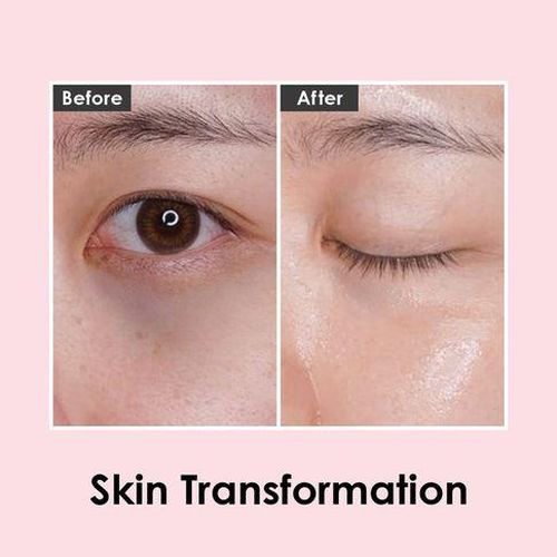 Патчи с экстрактом розы и пептидами Medi-Peel Hyaluron Peptide 9, фото