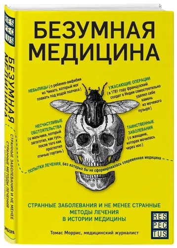 Безумная медицина. Странные заболевания и не менее странные методы лечения в истории медицины | Моррис Томас, купить недорого