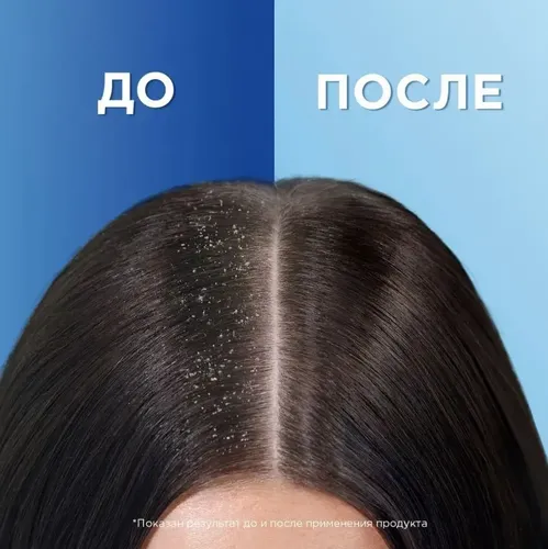 Шампунь против перхоти Head & Shoulders Ментол, 400 мл, купить недорого