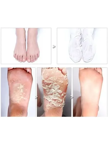 Отшелушивающие пилинг-носочки для ног Jigott Foot Peeling Care, 30 мл, фото