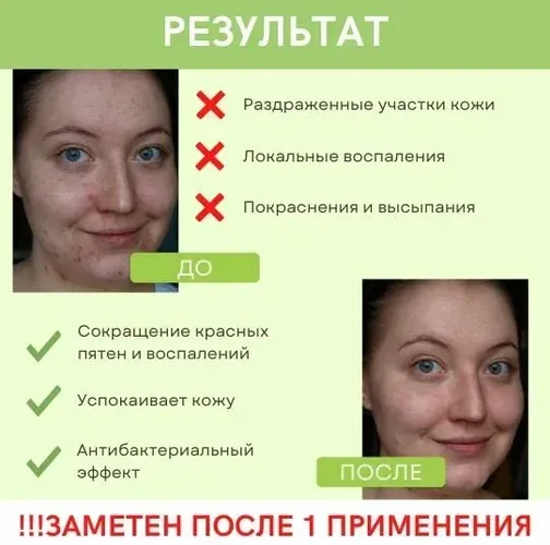 Корректор Dr.Jart спот для экстренной помощи для проблемной кожи Ctrl+A Teatreatment Soothing Spot, 15 мл, фото