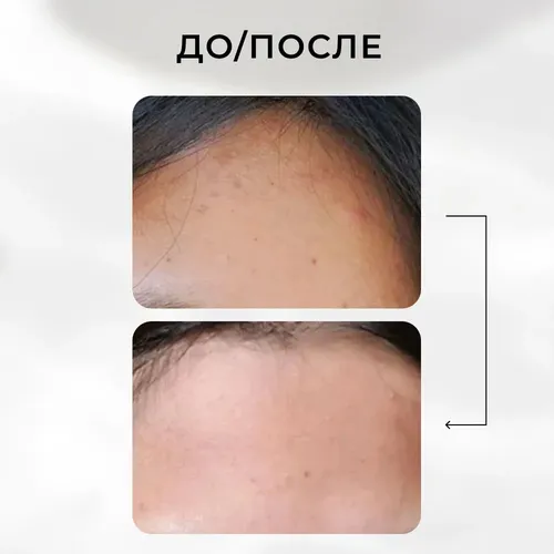 Тоник для лица с кислотами Cosrx AHA/BHA Clarifying Treatment Toner, 150 мл, в Узбекистане