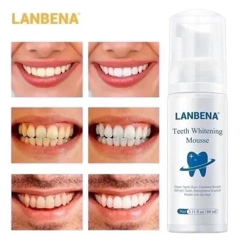 Отбеливающий мусс Teeth Whitening Mousse от Lanbena, 60 мл, фото
