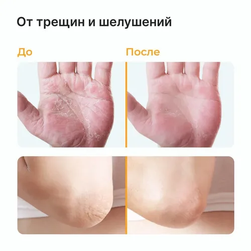 Крем-воск от трещин для очень сухой кожи Epil Profi BI-444, 100 мл, в Узбекистане