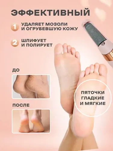 Пемза электрическая для ухода за ногами Pedi YD-43, Розовый