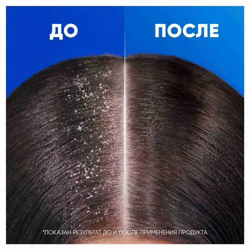 Шампунь Head & Shoulders Anti & Hairfall+ TH, 720 мл, в Узбекистане